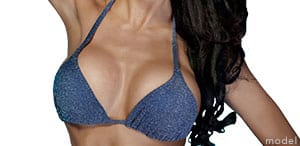 breast-augmentation