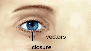 eyelid1b