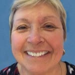 Mohs Nose Patient 01 Thumbnail After - 2