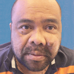 Mohs Face Patient 01 Thumbnail Before