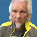 Mohs Nose Patient 09 Thumbnail After - 2