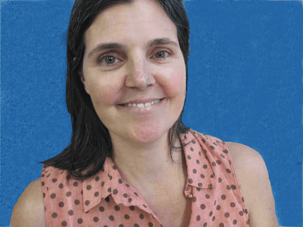 Mohs Nose Patient 11 Before