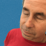 Mohs Nose Patient 17 Thumbnail Before