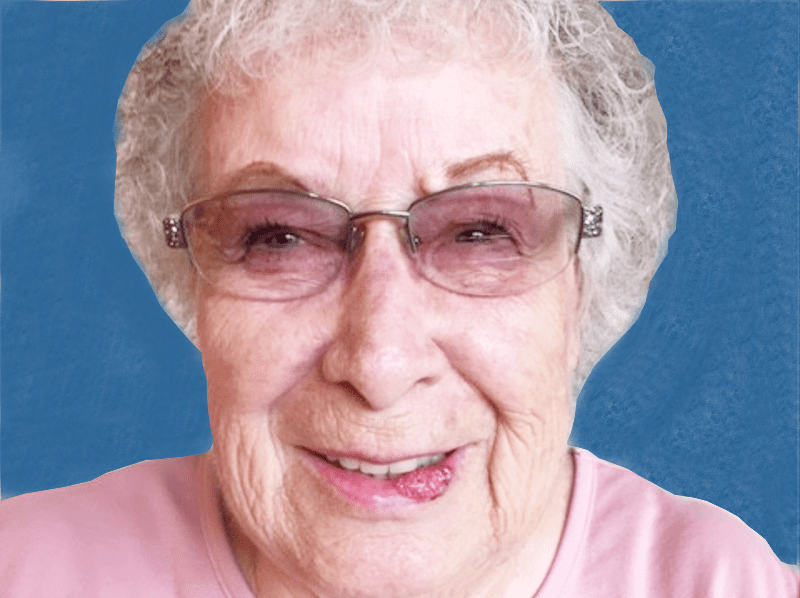 Mohs Lips Patient 08 Before