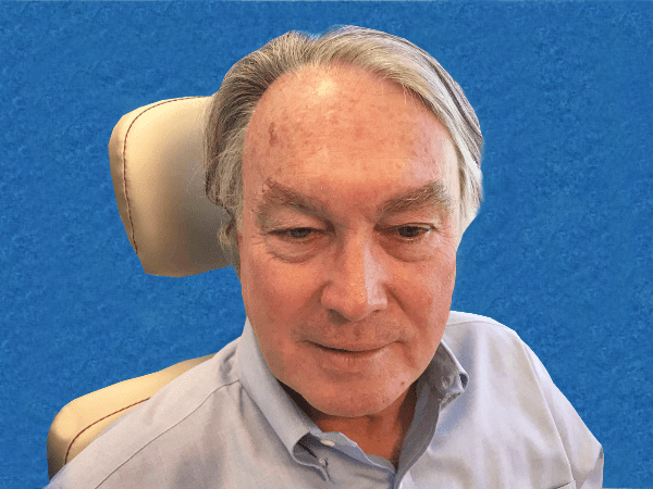 Mohs Face Patient 06 After - 2