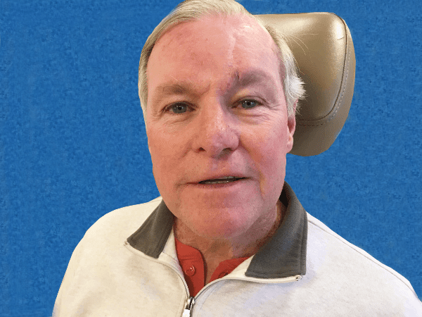 Mohs Nose Patient 20 Before - 2