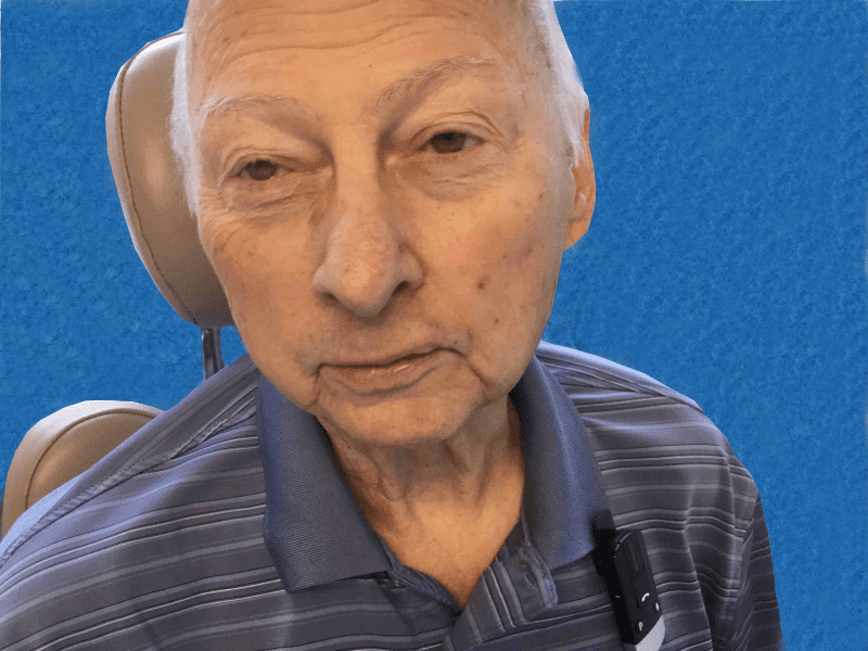 Mohs Lip Patient 10 After - 2