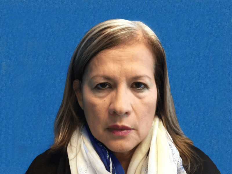 Blepharoplasty Patient 07 Before