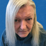 Excision Face Patient 01 Thumbnail After - 2