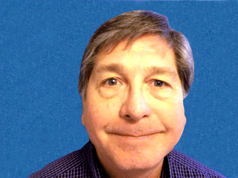 Blepharoplasty Patient 06 Before