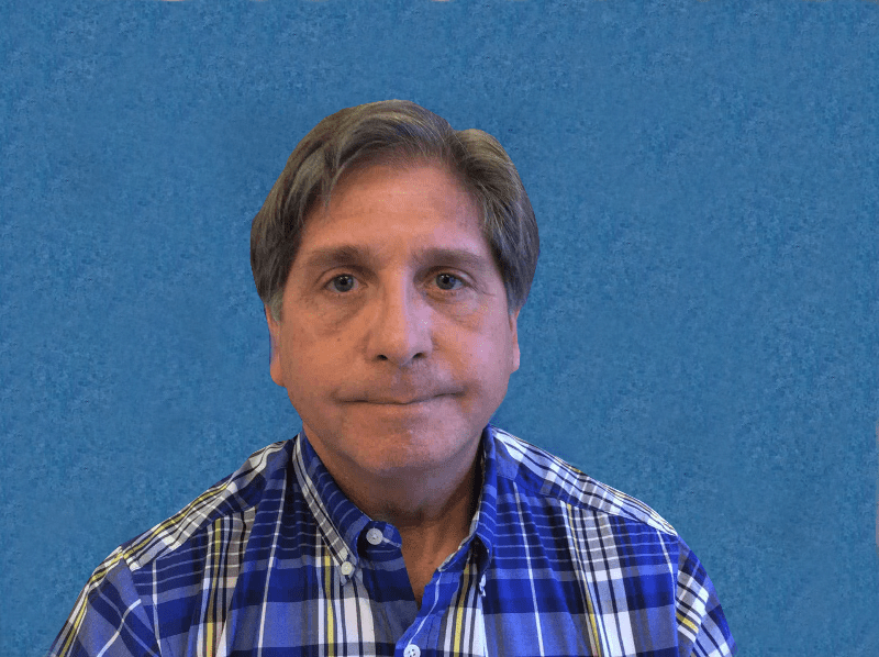 Blepharoplasty Patient 06 Before - 2