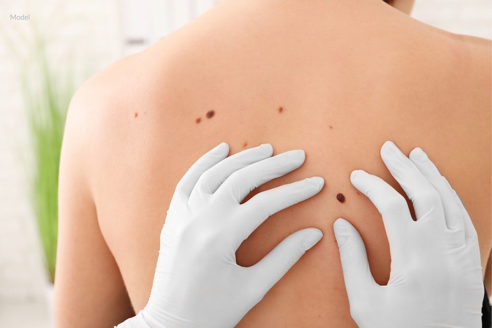Medical examination to determine if moles are cancerous.