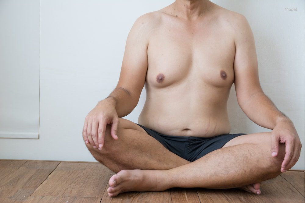 Man with gynecomastia sitting down.