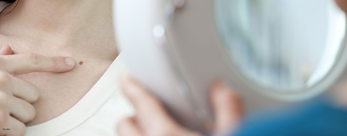 Woman pointing at mole on chest