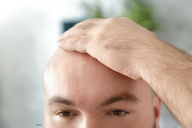  Close-up shot of a bald man with his hand on his head