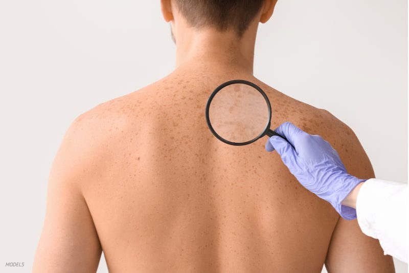 Man's back being examined for skin issues.