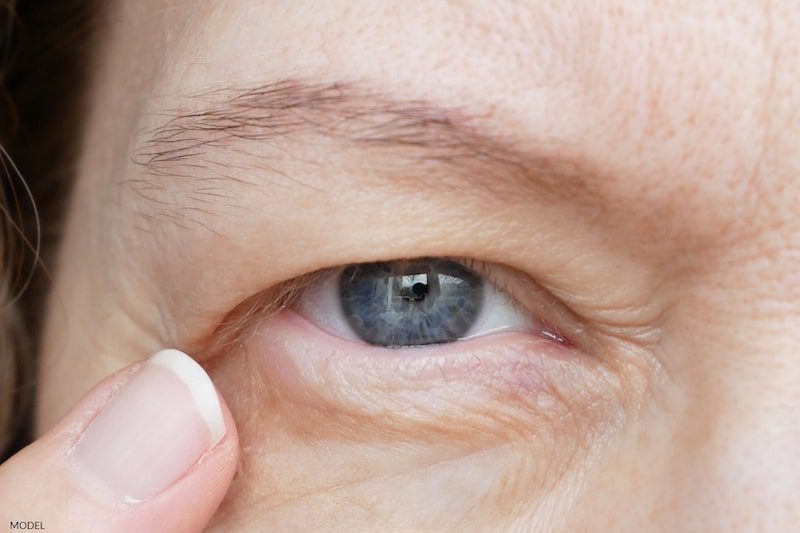 Close up of a middle aged woman's eye as her finger gently touches the skin on the side of her eyelid.