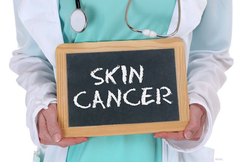 Closeup of a surgeon holding a board reading "skin cancer"