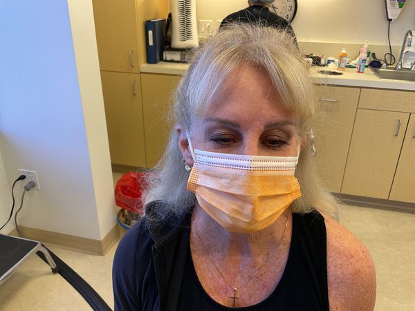 Mohs Face Patient 20 After - 2