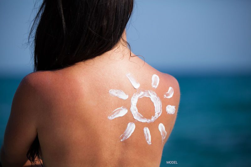 Woman with a sun drawn on her back with sunscreen.